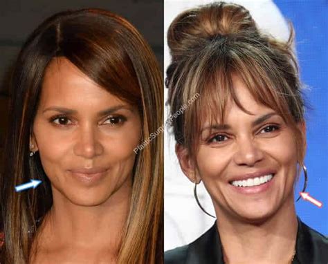 halle berry implants|Halle Berry: Before and After